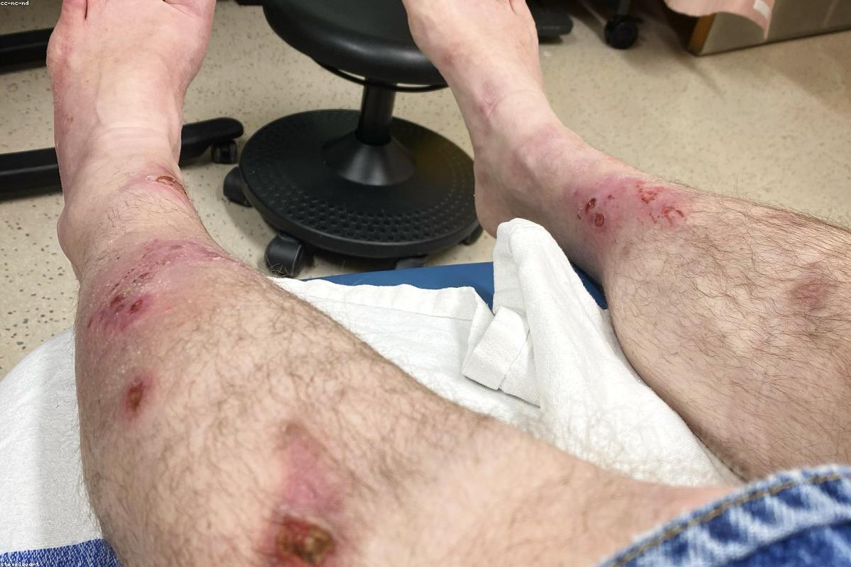 When Performance Anxiety Needs Professional Help